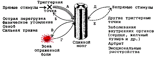 Триггерные точки – что это такое?