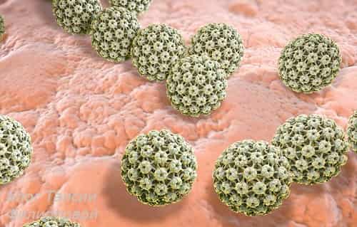 Virus papillomy - prichina poyavleniya podoshvennyh borodavok